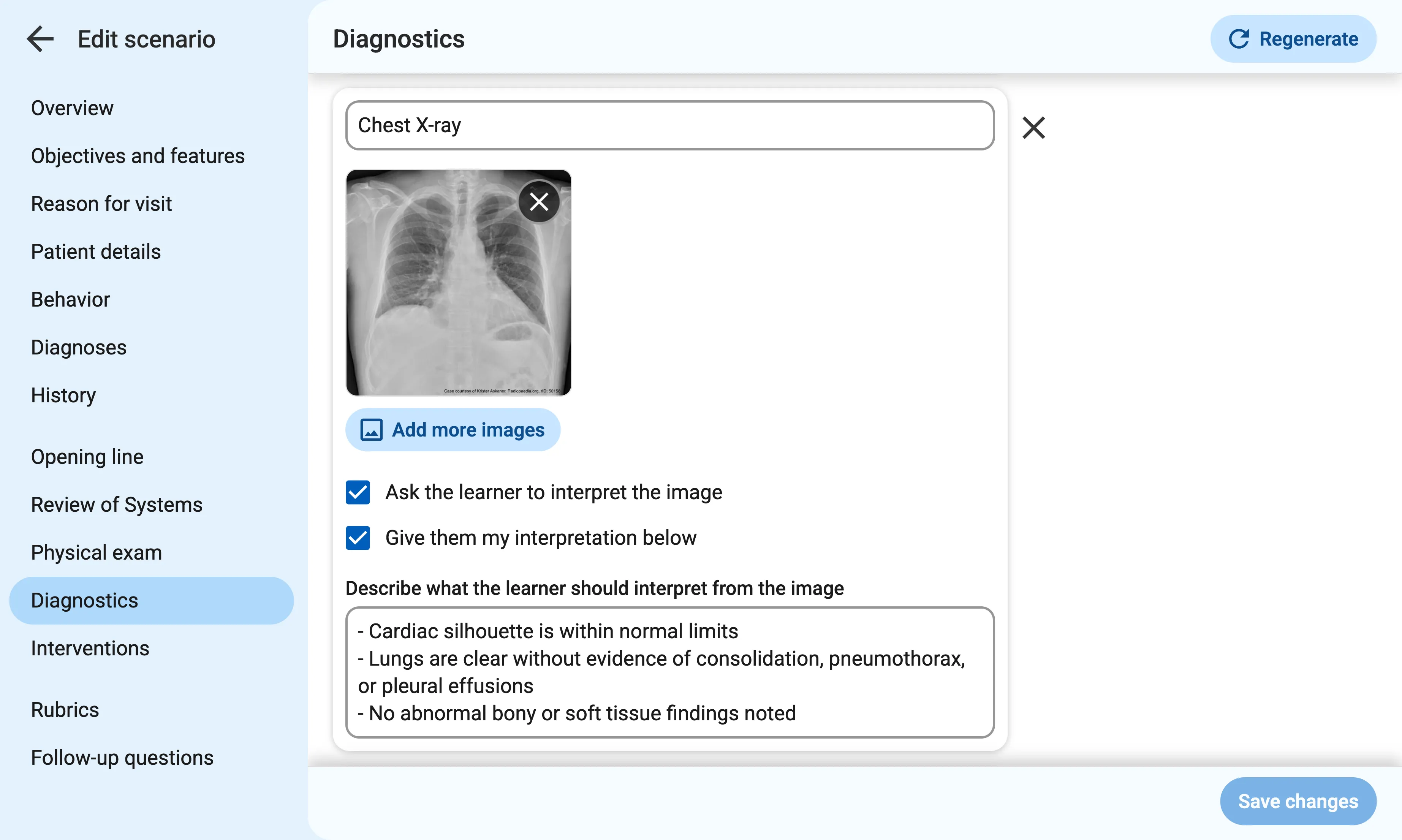 The diagnostics tab of the scenario creation form, showing a diagnostic titled "Chest X-ray". Below the title is a gallery of images with a single image of a chest X-ray and an X button in the corner. Below that, a button reads "Add more images". Below that, two checkboxes read "Ask the learner to interpret the image" and "Give them my interpretation below:", both checked. Below that, a textbox reads "Describe what the learner should interpret from the image" and written inside is "Cardiac silhouette is within normal limits..."